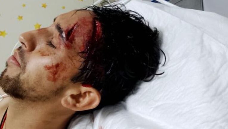 Sufre Diego Aguilar espeluznante herida