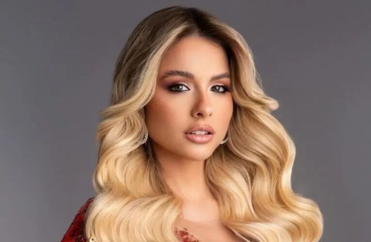 Miss Universo Argentina tiene alopecia; muestra la zona donde no le crece cabello: “Todos tenemos imperfecciones”