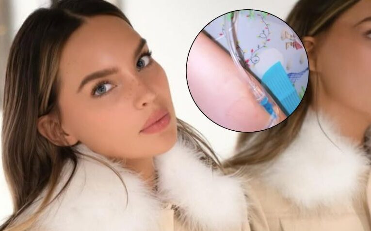 Belinda genera preocupación tras publicar foto recibiendo un tratamiento, ¿qué le pasó?