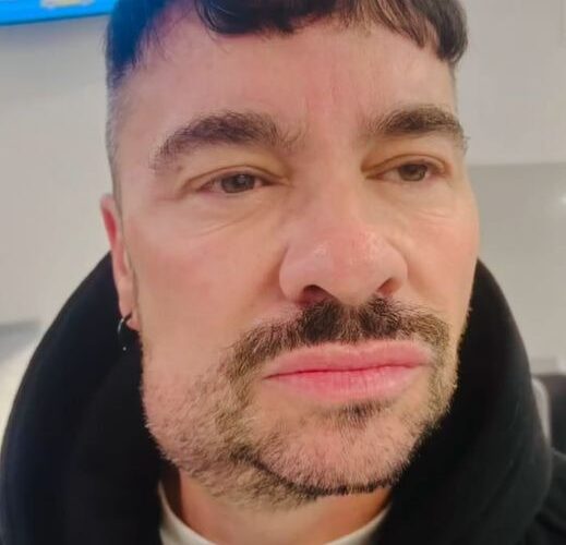 Shiky es hospitalizado de emergencia por segunda ocasión para una cirugía