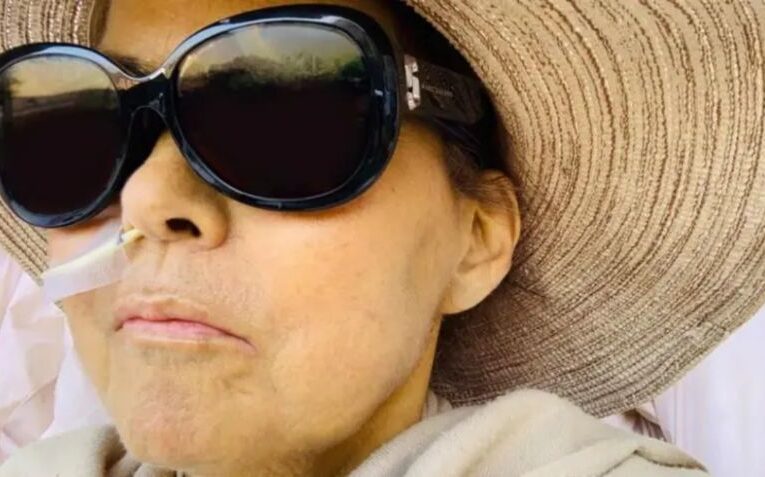 Mujer perdió casi 30 centímetros de estatura por esta extraña enfermedad