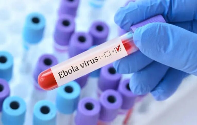 Confirman primer caso de ébola sin vacuna en Estados Unidos