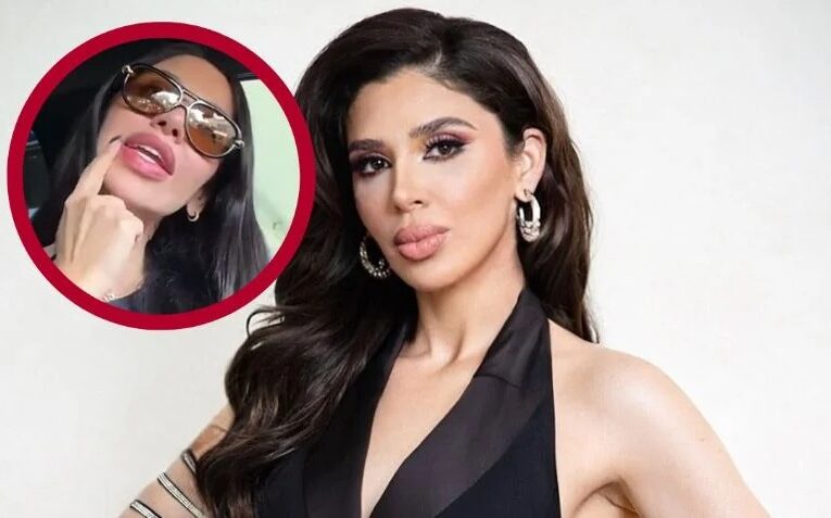 Emma Coronel revela problemas de salud por biopolímeros